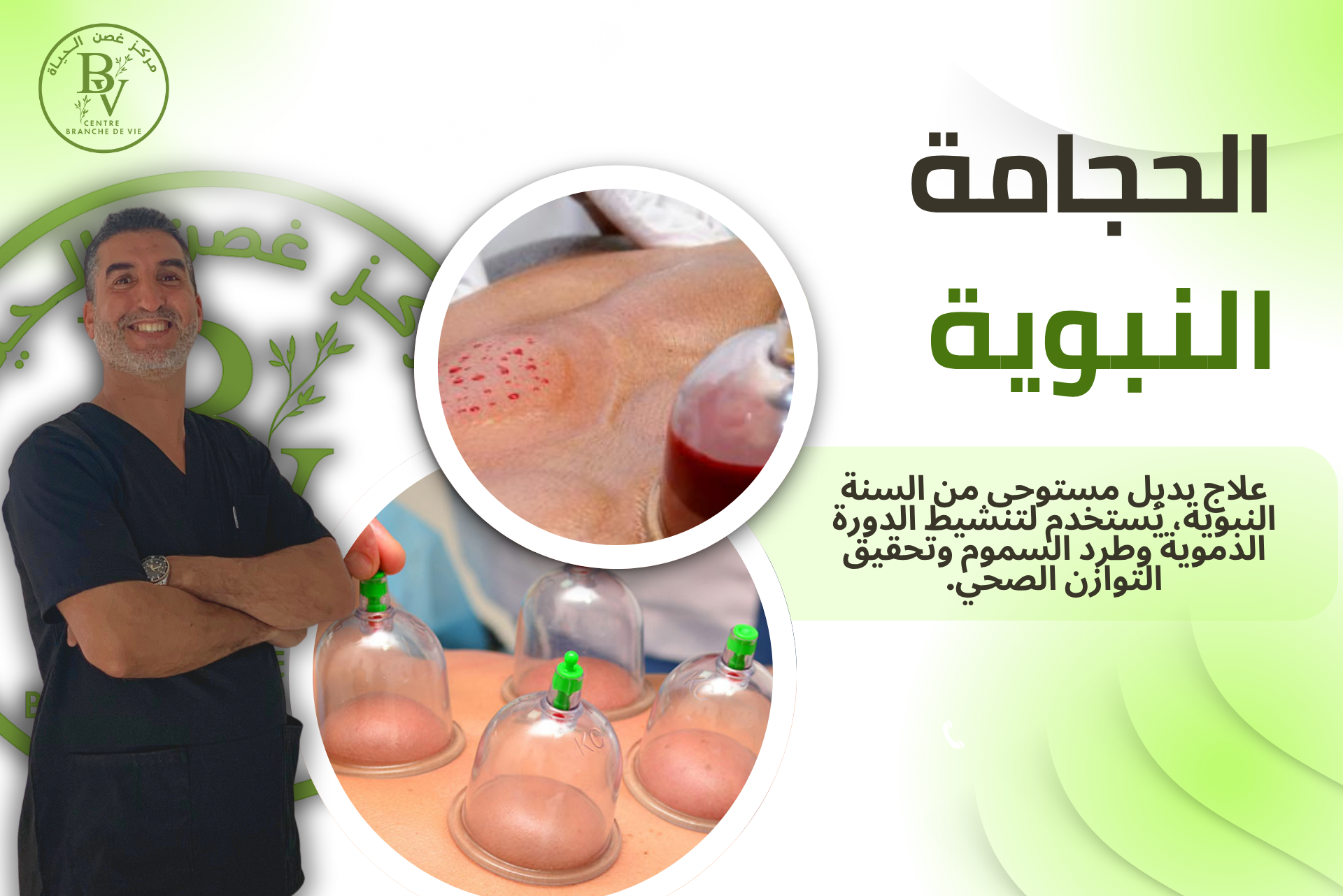 جلسة حجامة تقليدية لتنقية الجسم وتحفيز الطاقة | Séance de hijama pour purifier le corps et stimuler l’énergie