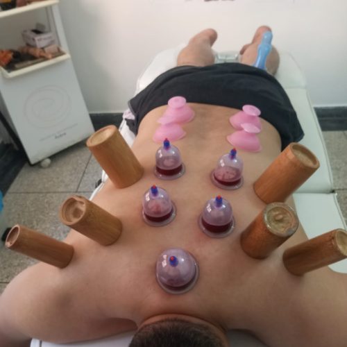 جلسة موسكا باستعمال الشيح لتسخين الجسم وتحفيز الطاقة | Moxibustion avec armoise pour chauffer et équilibrer l’énergie du corps